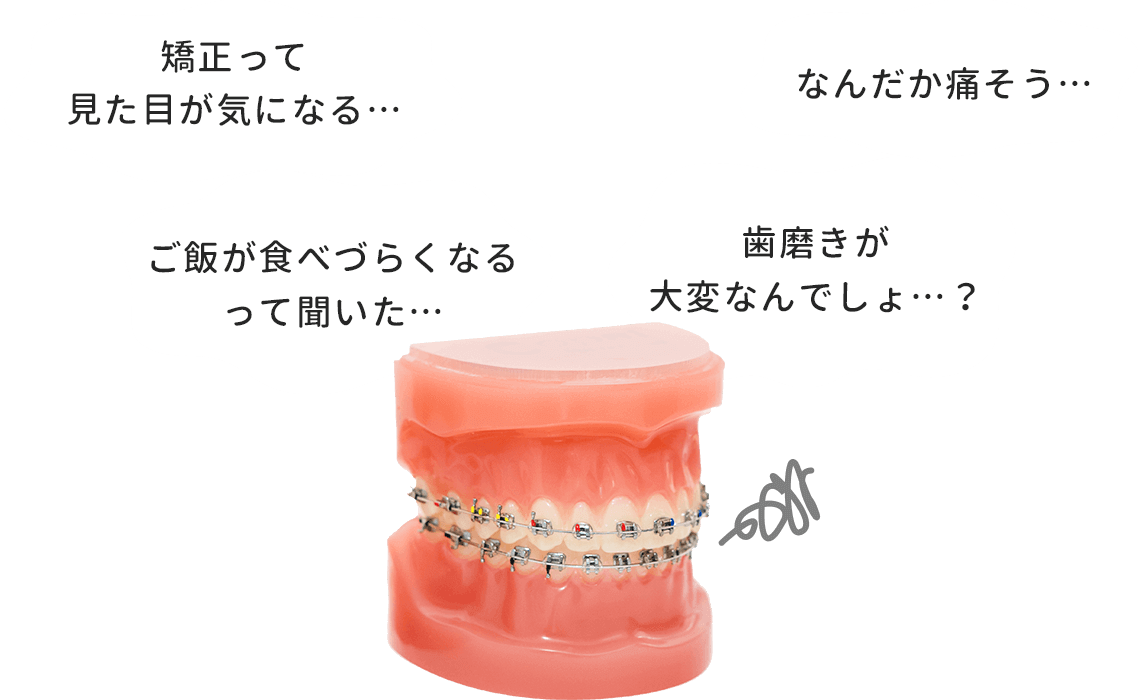 矯正のイヤなイメージ