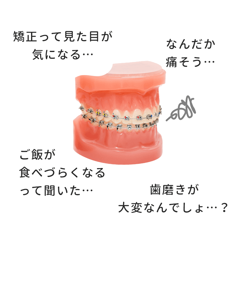 矯正のイヤなイメージ