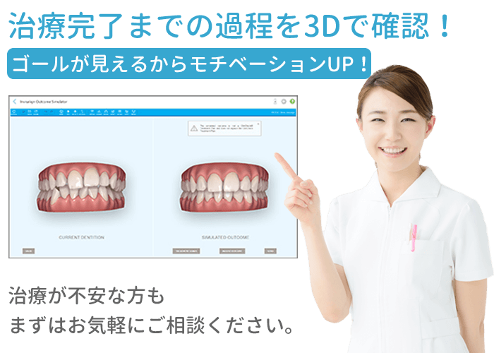 アウトカムシミュレーター