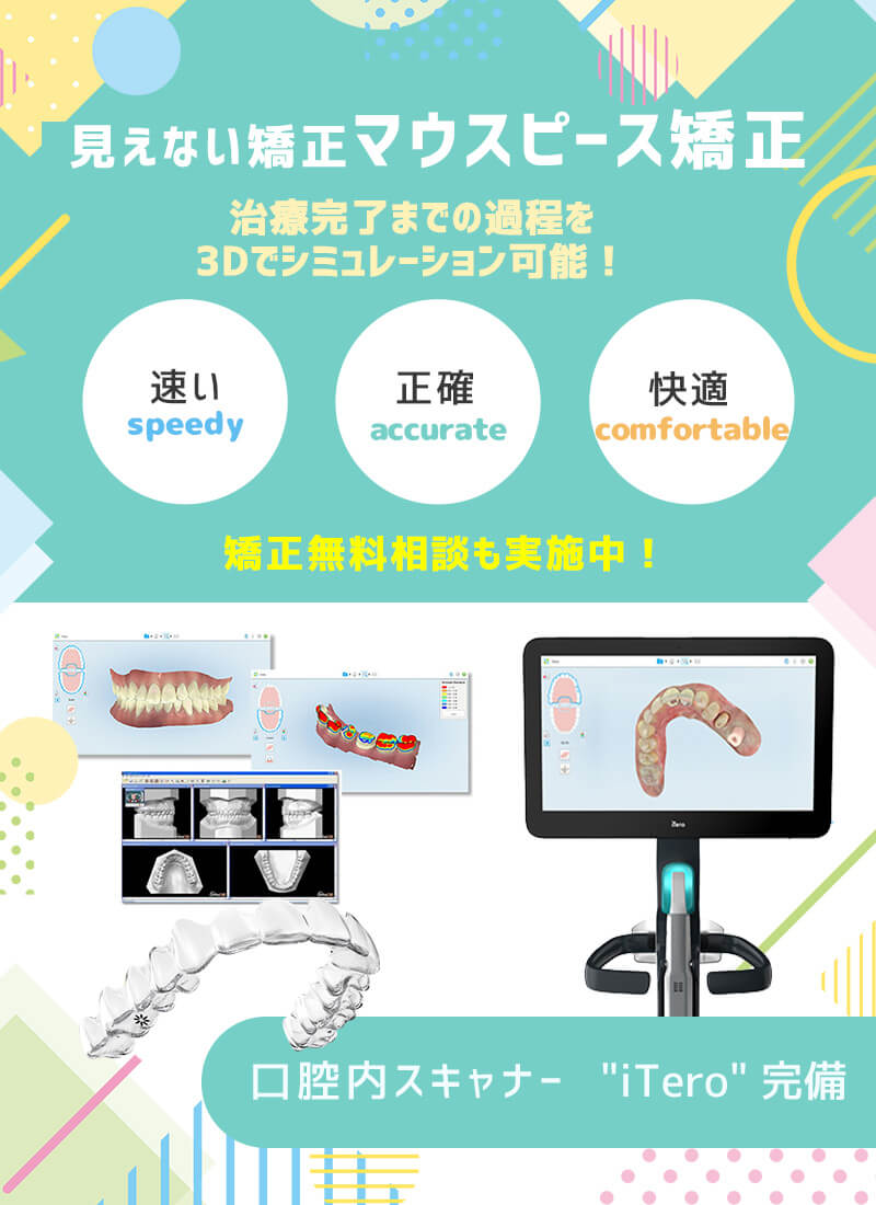 iTero、デンタルローン、マイオブレース